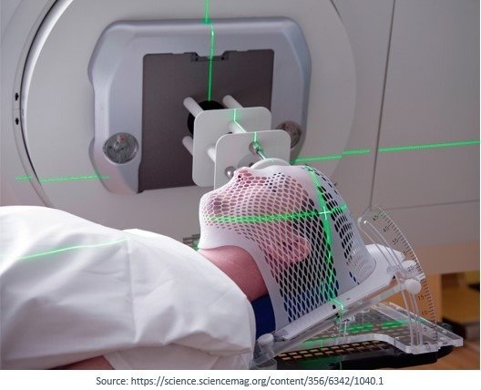 Treatment-of-Brain-Tumours by Stereotactic radiosurgery at Dr Rao's Hospital by Dr Rao