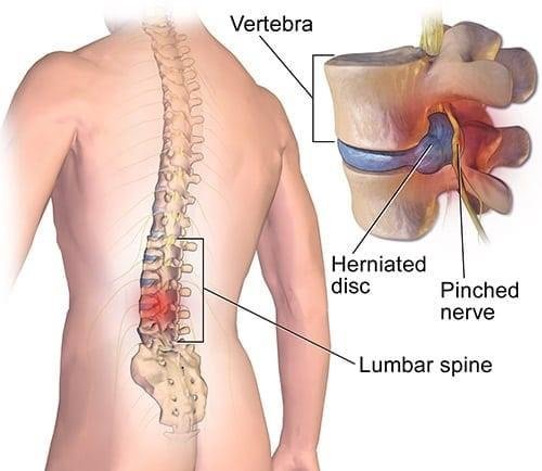 back-surgery at Dr Rao's Hosptial is the best