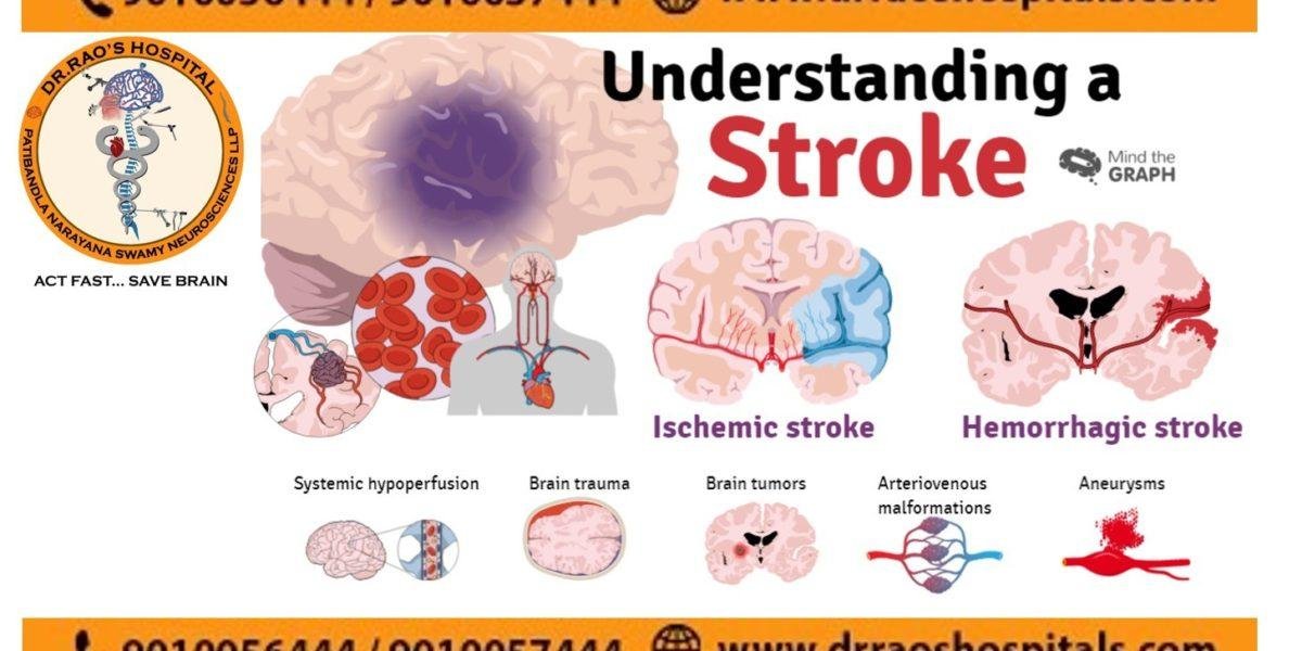 the best stroke-treatment-in-Guntur