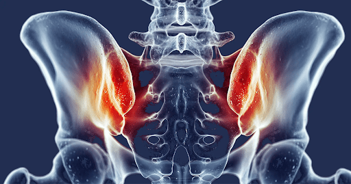 si-joint-dysfunction-self-test - the best SI joint fusion surgery at Dr Rao's Hosptial, Guntur