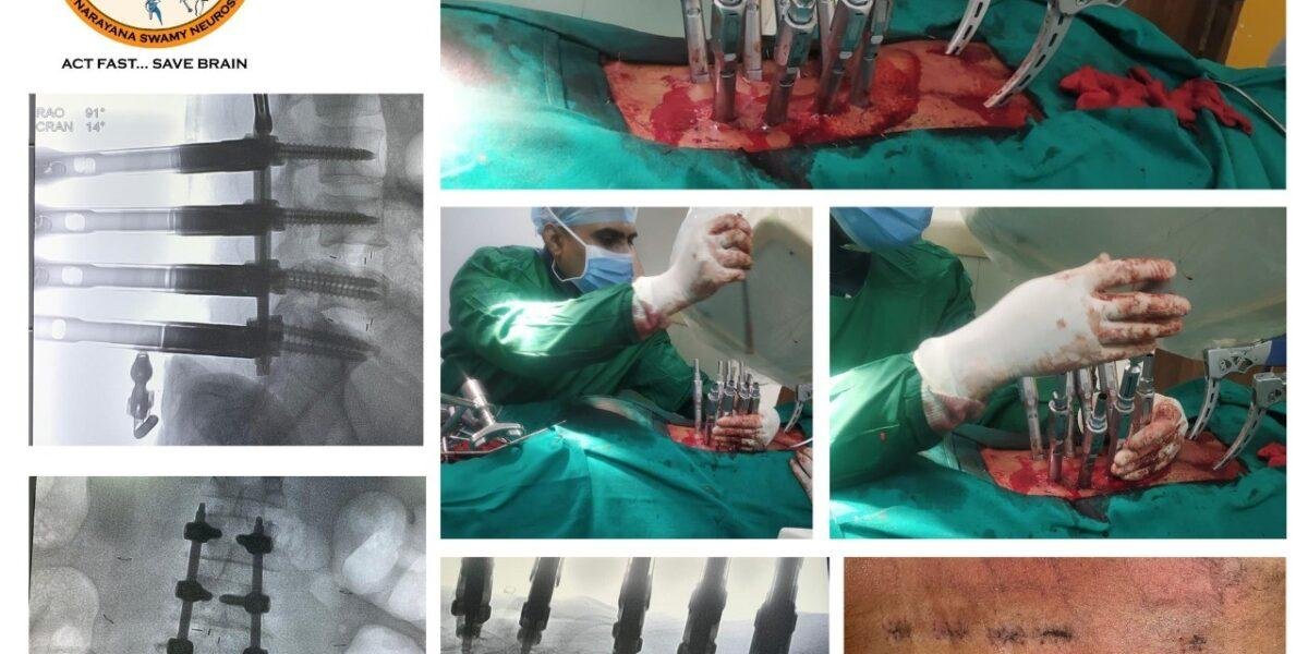 Advanced neurosurgery performed using minimally invasive techniques at Dr. Rao’s Hospital in GunturFusion