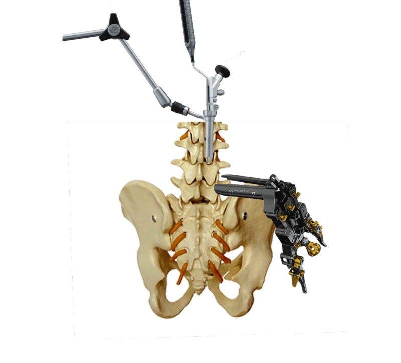 Spinal Surgeons Near Me - Dr. Rao at Dr. Rao's Hospital