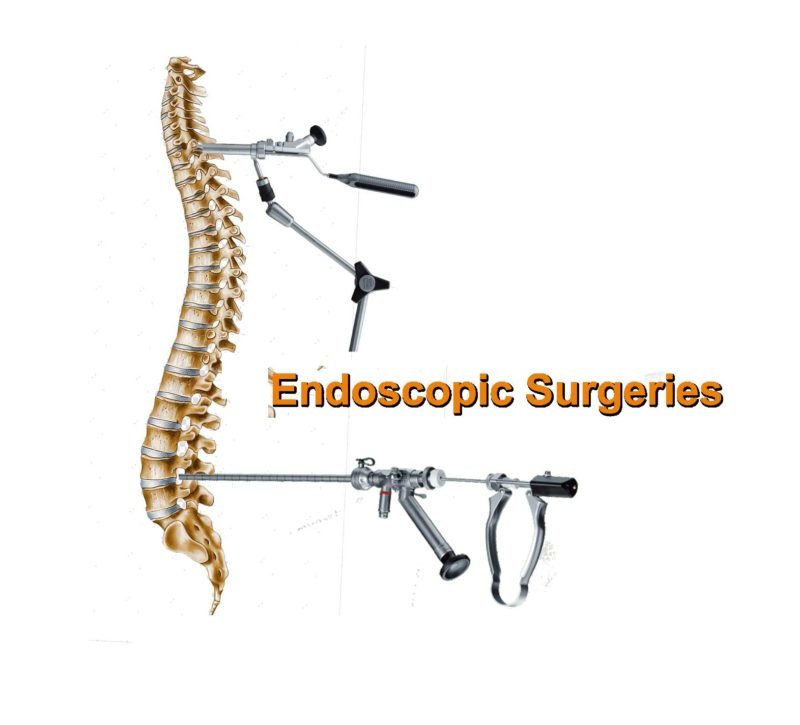 Spine Clinic Near Me: Dr. Rao at Dr. Rao's Hospital