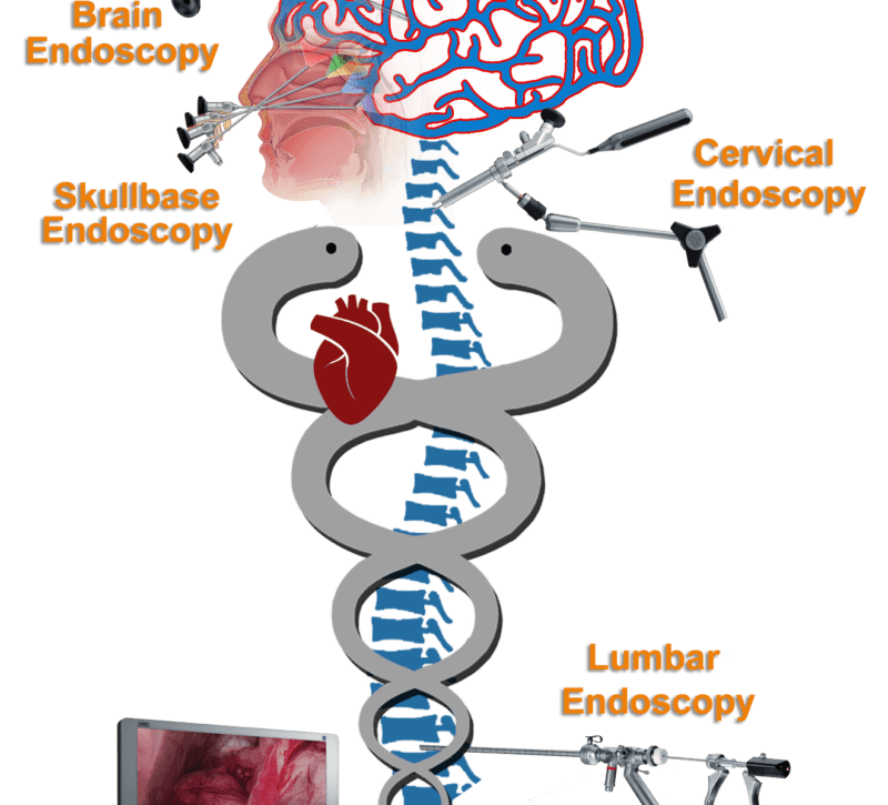 Spine Surgeon - Dr. Rao at Dr. Rao's Hospital