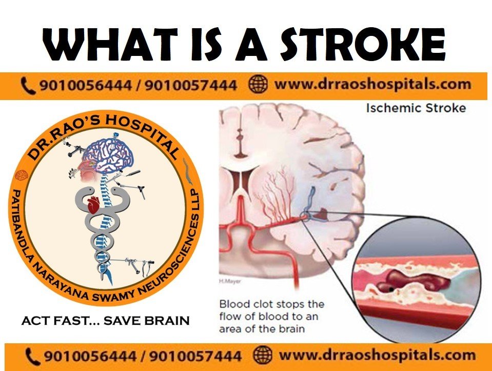 Exploring Outpatient Procedures in Neurosurgery Hospitals - Dr. Rao at Dr. Rao's Hospital