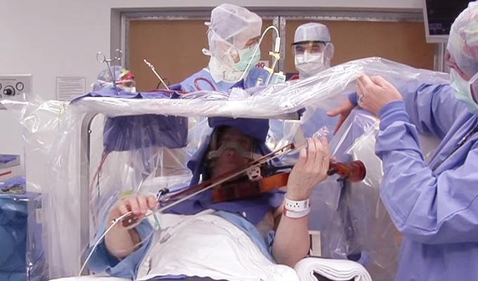 Awake Brain Surgery: Advancements in Mapping and Preserving Cognitive Function